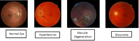 Innovative vision care technology allows early detection of vision loss and disease
