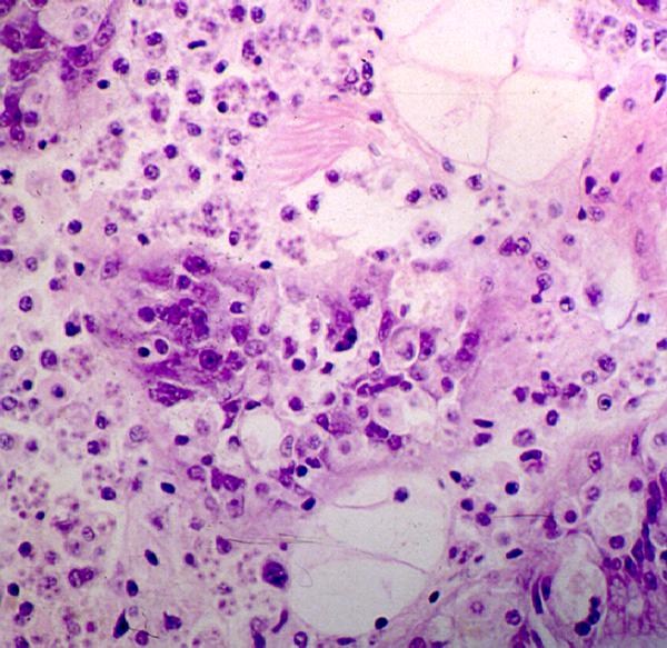 Bonamia cells, (dark pink area is Bonamia)