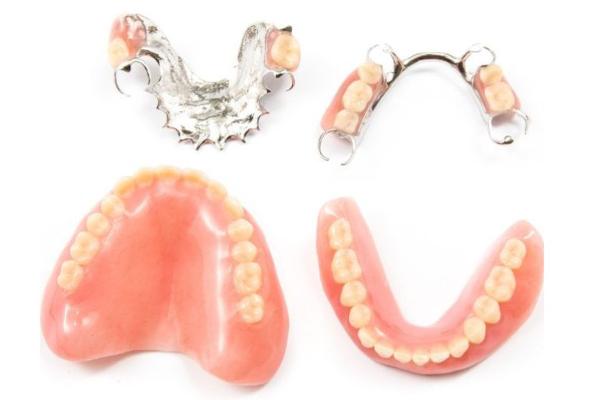 Different types of dentures to restore function and your smile