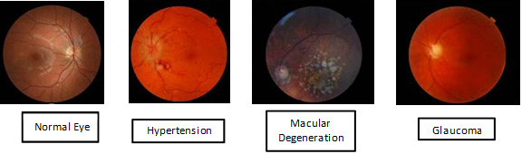 Retinal scan